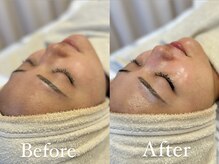 ザ パールズ(The Pearls)/抗酸化作用でお肌荒れを防ぐ