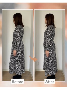 藤沢南口整体サロン/20代女性 骨盤と肩と首を矯正