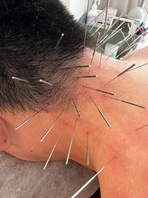 けんたろう鍼灸院