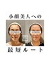 【小顔頭蓋骨矯正＋美肌美顔器4回モニターコース】¥44,000→¥25,000