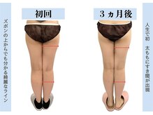ビオラス 高崎店/美脚効果☆秘訣は骨盤矯正に！