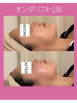 シーズ(C'ies)/脂肪燃焼オンダリフト