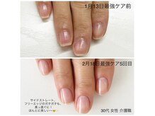 リバティー(liberty)の雰囲気（最強ケアで爪が変わる。5回でここまで美しく健康に実感続く指先）