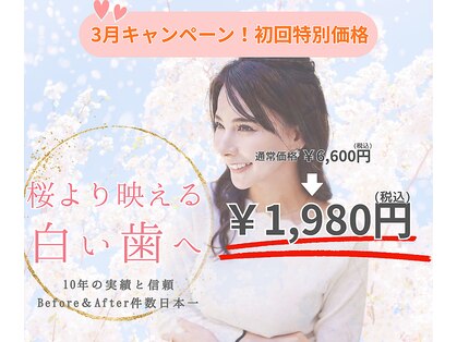 ホワイトニングショップ 宇治店の写真