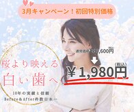 ホワイトニングショップ 宇治店