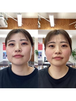ストレッチヒーロー 姫路広畑店/お顔の輪郭に注目!