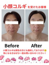 アール(R)/小顔コルギ
