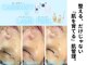 ベリンダ(BELINDA)の写真