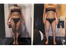 パーフェクトボディプレミアム 大阪難波店(PERFECT BODY PREMIUM)/お客様　ビフォーアフター（29）