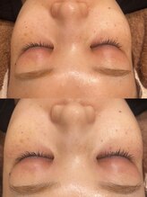 アージル(Argyll)/Waxxxx使用！スキンケアワックス