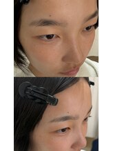 ネマウム(nemaum)/