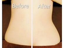 アペリラックス(ape relax)の雰囲気（ウエストのくびれ作ります［表参道/毛穴/エステ/ブライダル］）