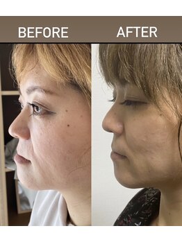 アイリス鍼灸マッサージ 上野院(Iris鍼灸マッサージ)/私です。