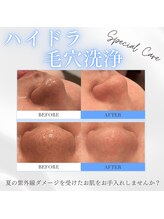 フルールスレーヌ(Fleur Sereine)/美容液で洗う本気の毛穴洗浄☆