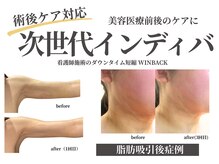 ノーブルノアール(Noble noir)の雰囲気（現場経験豊富な看護師による術前術後ケア。心身のDTを最小限に♪）