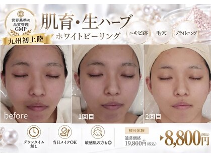 クリニカルエステ イーズ 三宮店の写真