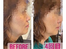 サロン ヌーク(salon Nook)/フェイシャルケア