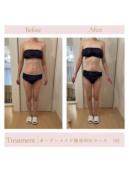 エミル(Emillu)/＊Body_ビフォーアフター