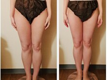 マナ(mana)/脚のむくみ解消初回体験