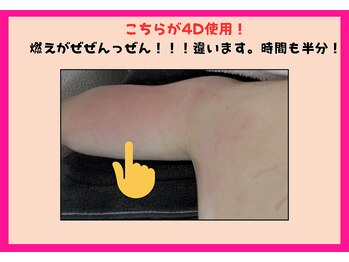 フレクシー/４D使用　痩身／痩身エステ