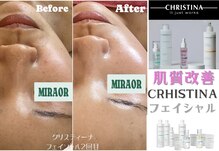 ミラー(MIRAOR)