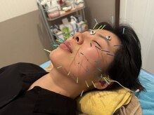 張鍼灸整体院