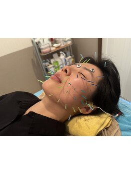 小顔になりたい