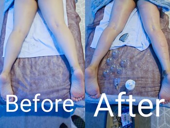 ドーヴ(Dove)/痩身大人気♪痛いよ??