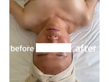 ラ セメリエ(La S'aimeriller)/経絡リンパマッサージ