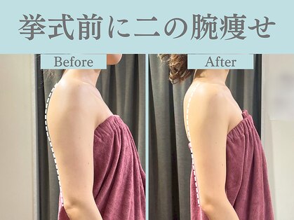 フローフシ∞の写真