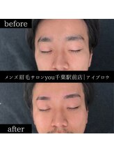 ユー 千葉駅前店(you)/ビフォ－アフター写真