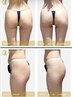 【座るだけヒップケア！】フェムケア×ダイエット ビジリスお試し10分￥2000