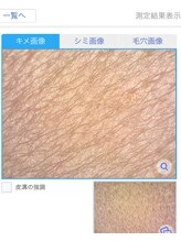 プリンセスフォー/肌のキメを診断機でチェック