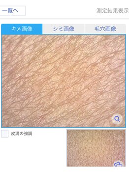 プリンセスフォー/肌のキメを診断機でチェック