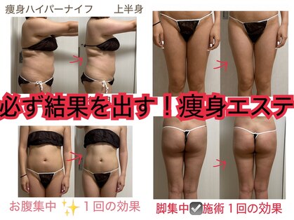ピクシー(pixie)の写真