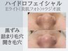【黒ずみ＆つまり毛穴】ハイドロ毛穴洗浄×美肌フォト◇毛穴レス美肌へ