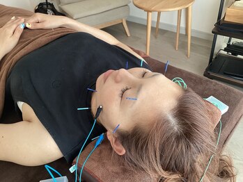 ハリファ鍼灸院 横浜関内院(HariFa鍼灸院)/美容鍼