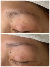 マリオネット(MARIONETTE)/ハリウッドブロウリフト