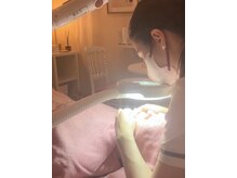 ディンプル(Dimple)