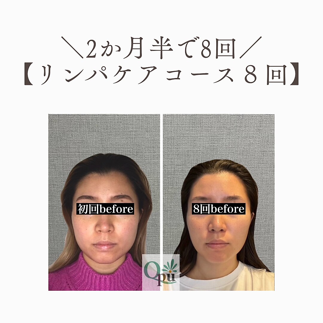 ◾️最終価格◾️はじめての人のための頭蓋骨矯正 はじめての人のための頭蓋骨矯正 | 医療情報研究所 DVD教材ストア
