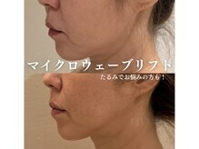 痩せるのは当たり前！他サロンとの圧倒的な違いをご実感下さい♪
