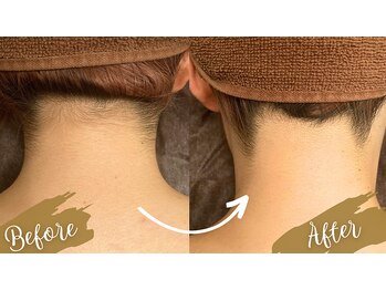 チャンティック(Cantik)/うなじケア