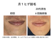 ダーウィン(Darwin)/毎日の髭剃りから解放！