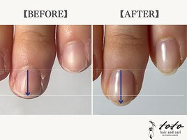 【toto式】自爪育成ネイルケア