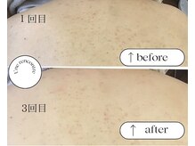 ユヌランコント 岐阜店(Une rencontre)/エンビロン