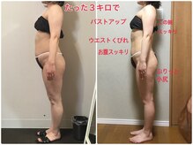 オージャス(OJAS)/40代○○様の変化　痩ボディーへ