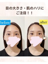 カオノツボ(kaonotubo)/フェイシャルリフレ75分初回