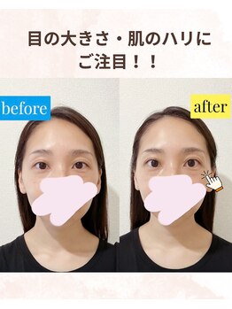 カオノツボ(kaonotubo)/フェイシャルリフレ75分初回