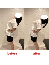 ナオル整体 福岡香椎院(NAORU整体)/20代女性施術事例【腰の痛み】