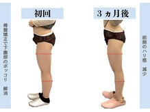 ビオラス 高崎店/前ももの張りも撃退！